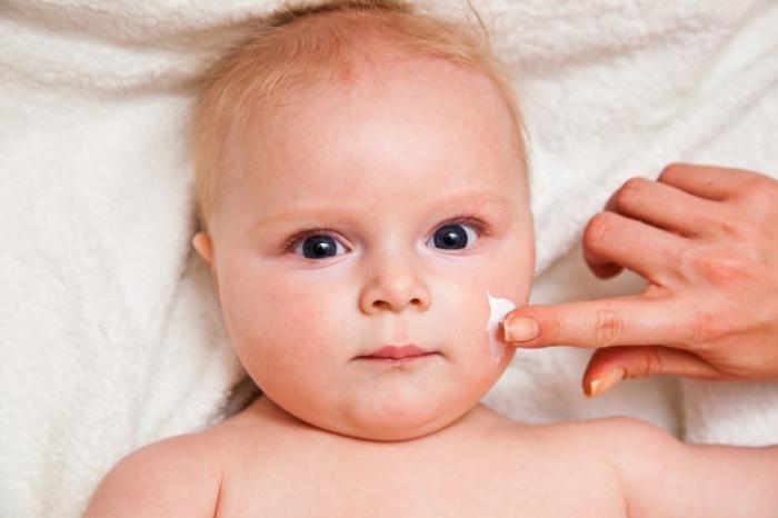 Como é o tratamento da dermatite atópica em uma criança?